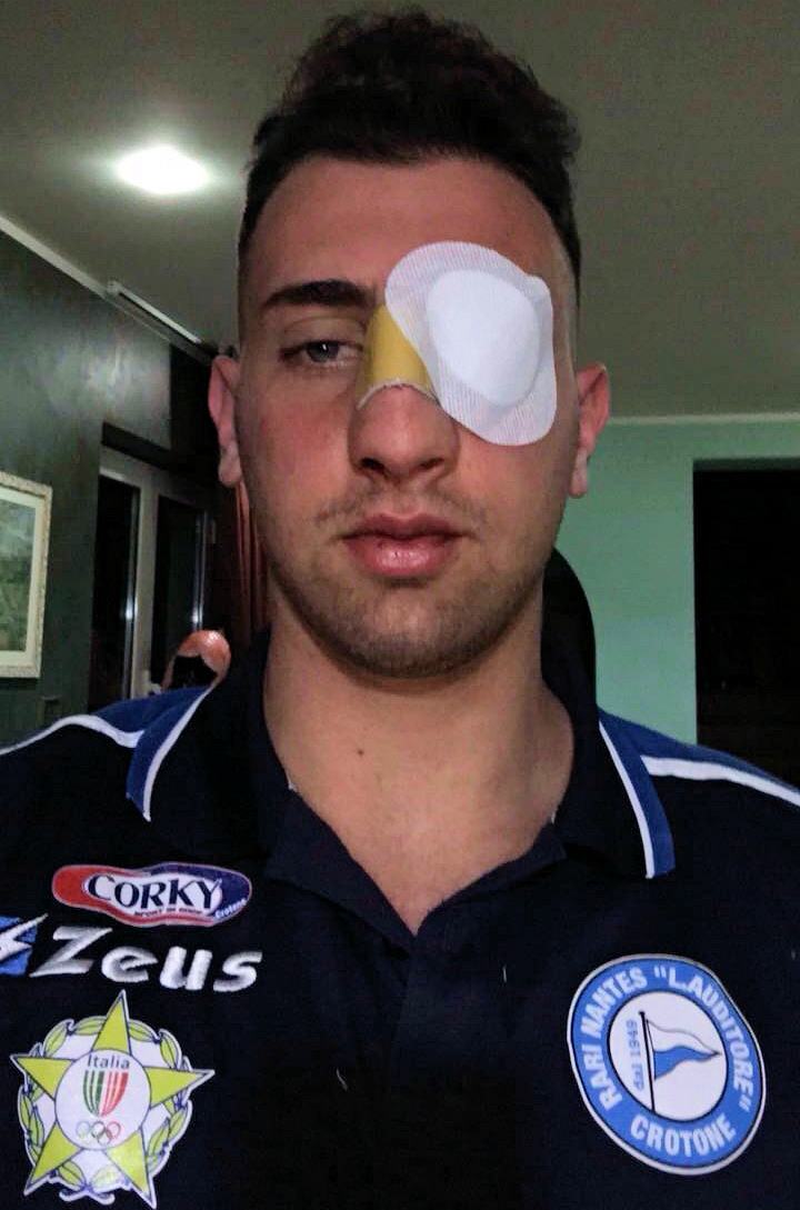 Pallanuoto, Cosenza - Crotone: portiere aggredito per una 'linguaccia' al presidente finisce in ospedale 53 Portiere Pasquale Palermo KR