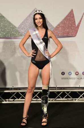 Chiara Bordi Miss con protesi
