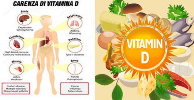 Oggi a Figline Vegliaturo, incontro di Liberi nella Sclerosi Multipla e Pro Loco 55 carenza vitamina d