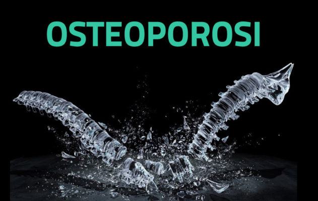 Osteoporosi: terapie sofisticate ed esami all’avanguardia per curarla 57 OSTEOPOROSI 1 1024x649