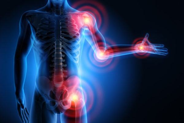 Osteoporosi: terapie sofisticate ed esami all’avanguardia per curarla 56 medicina online dott emilio alessio loiacono medico chirurgo roma malattie reumatiche cosa sono curano pericolose riabilitazione nutrizionista infrarossi accompagno commissioni cavitazio