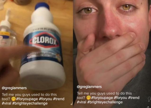 challenge tik tok Bright Eye Challenge