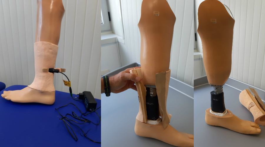 protesi inail lamezia 01