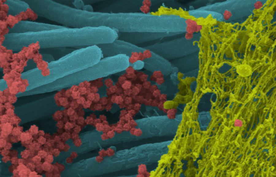 Immagini Università Carolina del Nord Unc New England Journal of Medicine 01 1