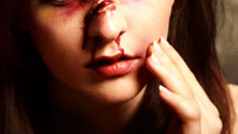 7b30c310 amante picchiat 1