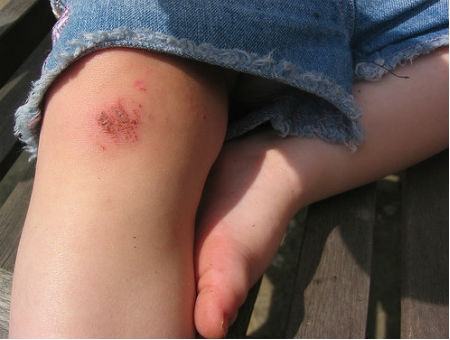 7d01dafdb7473020d4df6d5b72aaa037