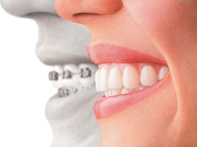 9267284e7733f4bec00d2e114d3f3ba1