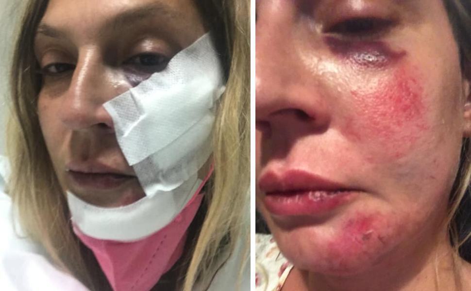Beatrice docente aggredita a Tortora