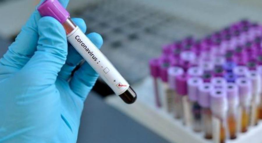 Coronavirus 9