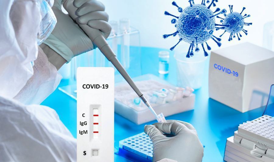 Coronavirus anticorpi