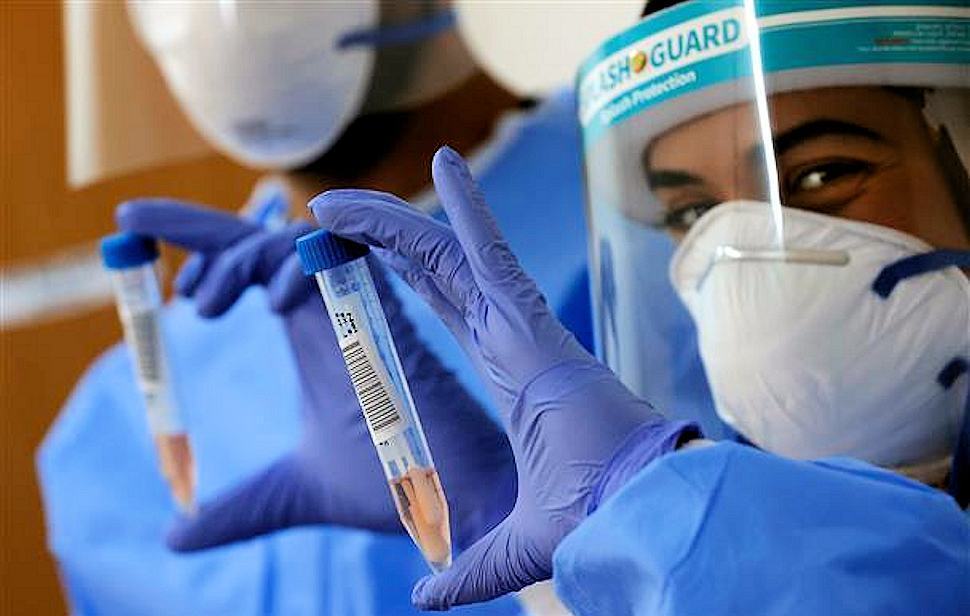 Crollano i nuovi contagi in Calabria (+70), calano anche i tamponi. Da ieri 2 vittime 51 Coronavirus medici2 1 9