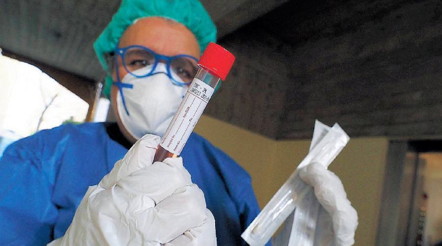 Coronavirus tampone 20