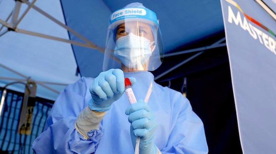 Coronavirus tamponi 24