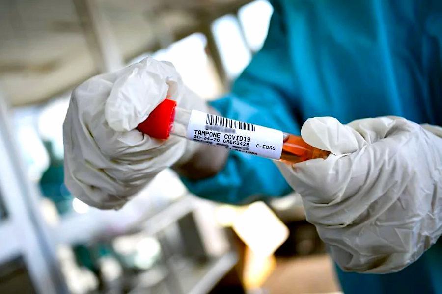 Coronavirus tamponi 7