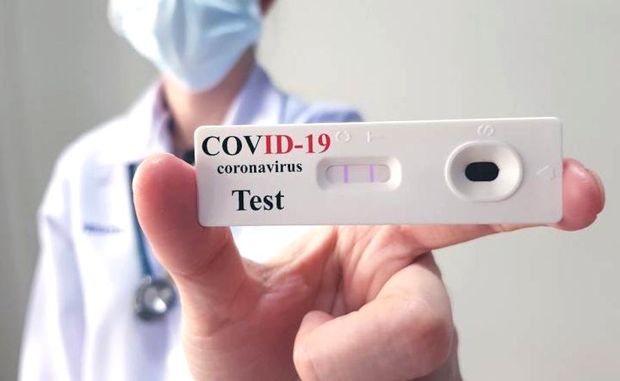 Coronavirus test 12