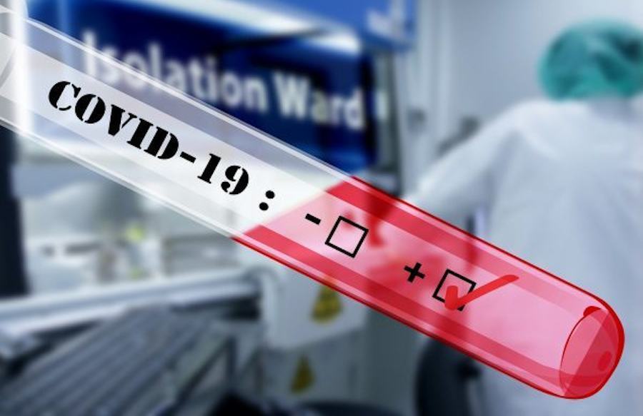 Coronavirus test 3