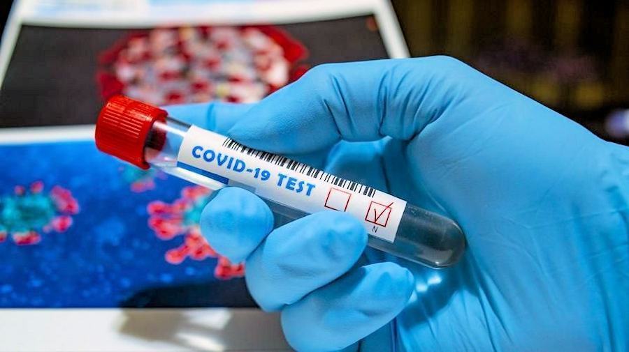 Coronavirus test 7