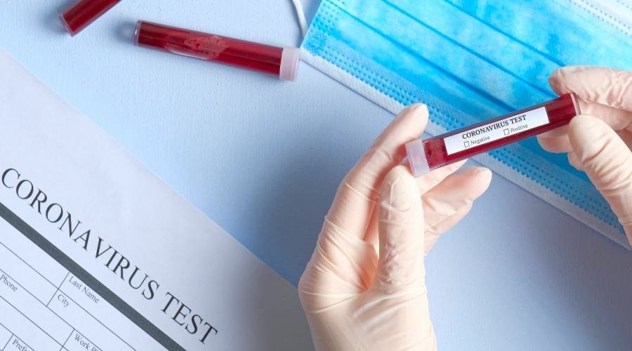 Coronavirus test3 1