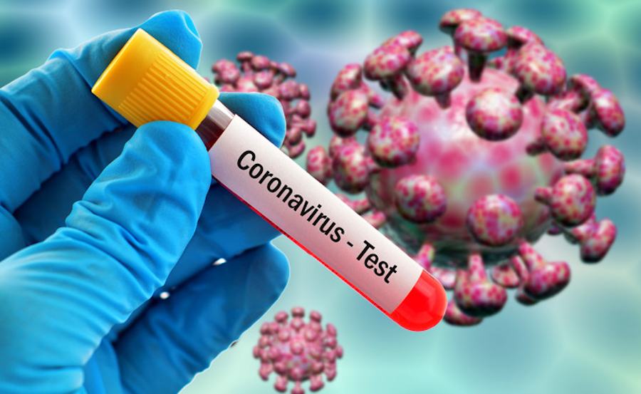Coronavirus test5 2
