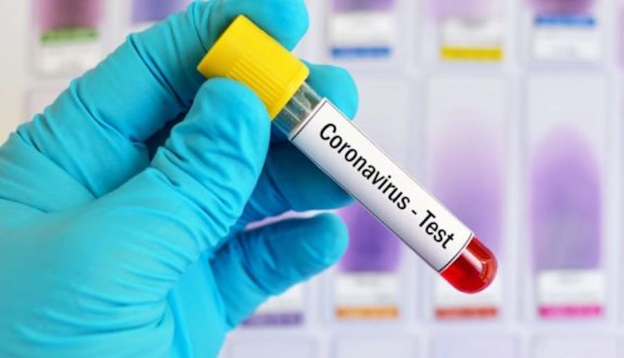 Coronavirus test6