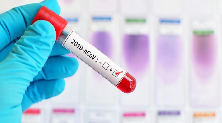 Coronavirus1 2