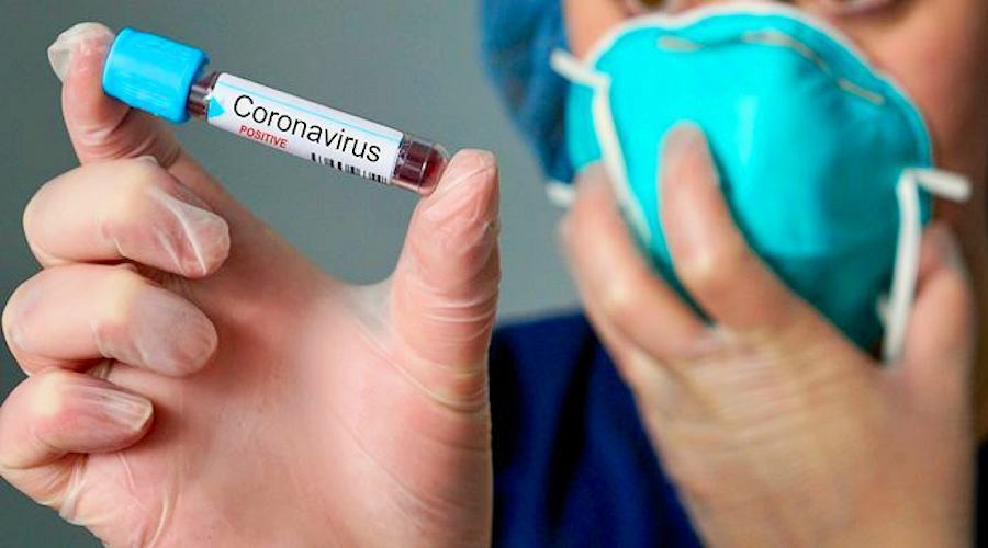 Coronavirus2 2 2