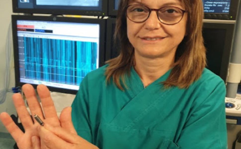Castrovillari, impiantato il pacemaker più piccolo al mondo 51 De Bonis pacemaker