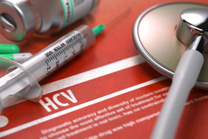 Epatite C