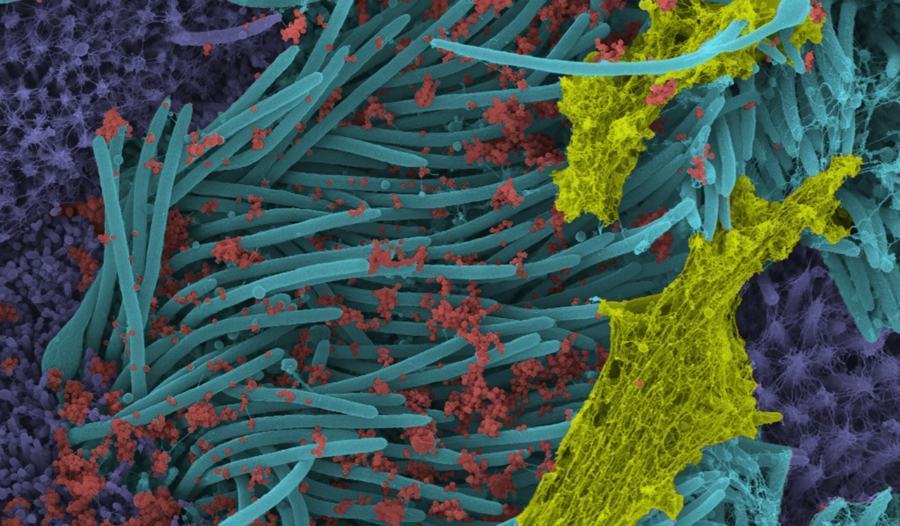 Immagini Universita Carolina del Nord Unc New England Journal of Medicine 01 2