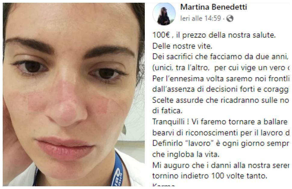 Mini-multa no vax "la mia faccia vale solo 100 euro". Burioni "così è una buffonata" 53 Martina bendetti