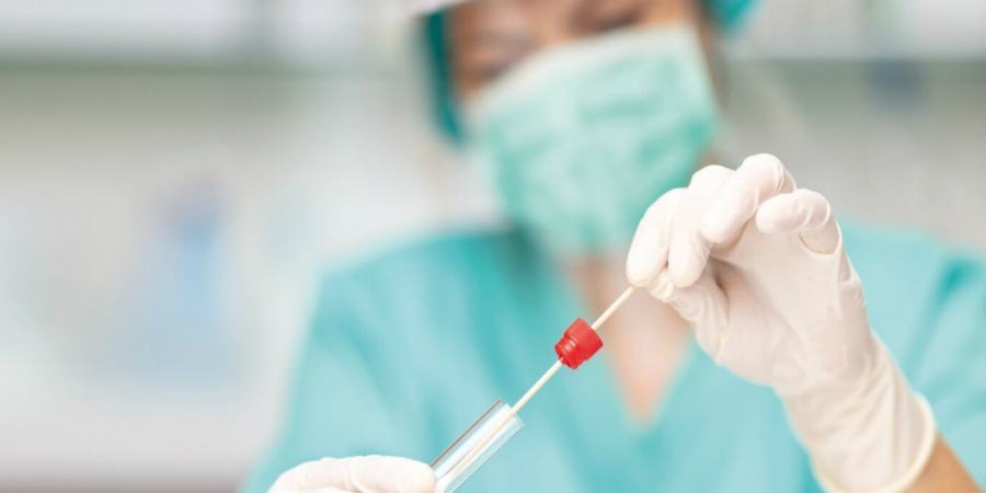 Tamponi antigenici e molecolari