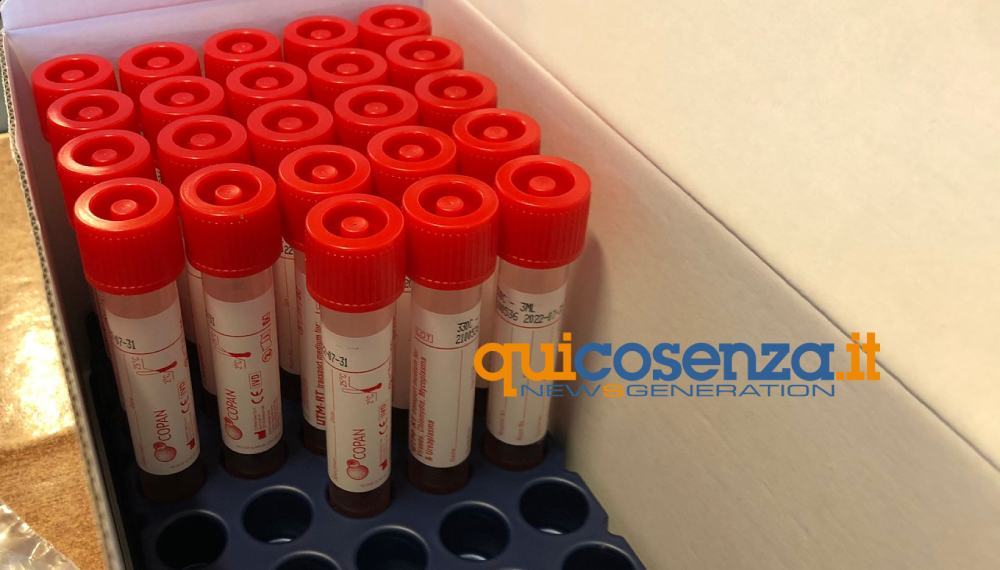 Coronavirus, 72 nuovi positivi 51 Tamponi usca cosenza via stadi 02 2
