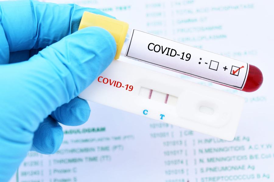 Test Coronavirus 3
