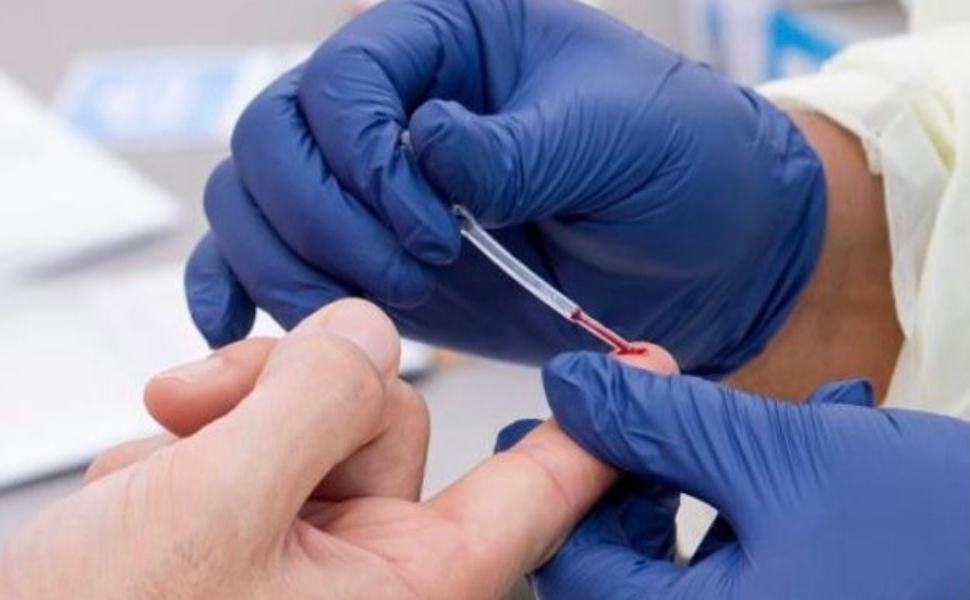 Prevenzione Epatite C: prosegue progetto ESP negli istituti penitenziari calabresi 51 Test Epatite C