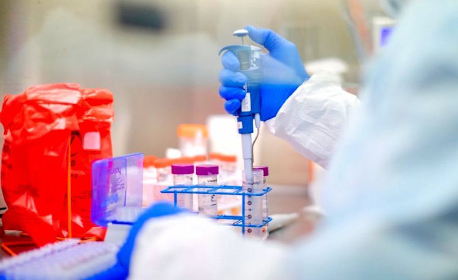Test laboratorio covid
