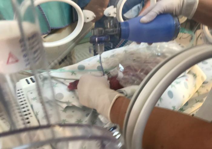 Partorisce in elicottero: bimbo prematuro salvato e trasportato all'Annunziata di Cosenza 51 bimbo prematuro