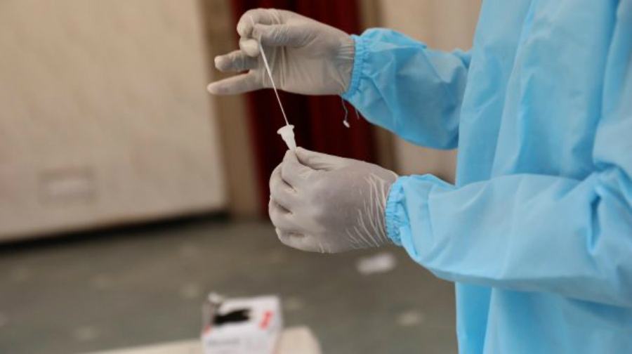 coronavirus tampone 37