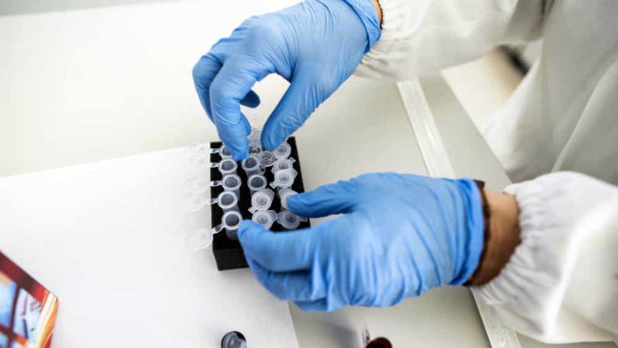 Cosenza: processati i primi tamponi, un nuovo contagio e 15 negativi 51 coronavirus tamponi 6