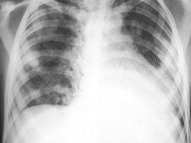 d0ba0ebed6fd08675dde5ccf2894dedc