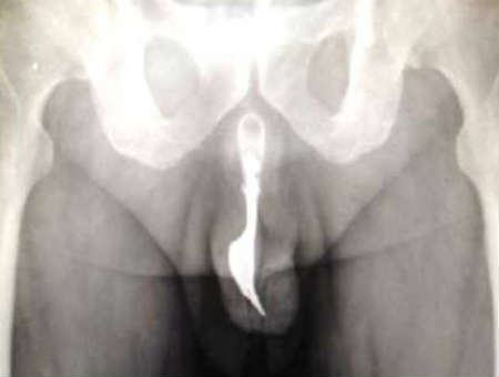 d9a30c76bc64f924c74402cd775fa9b5