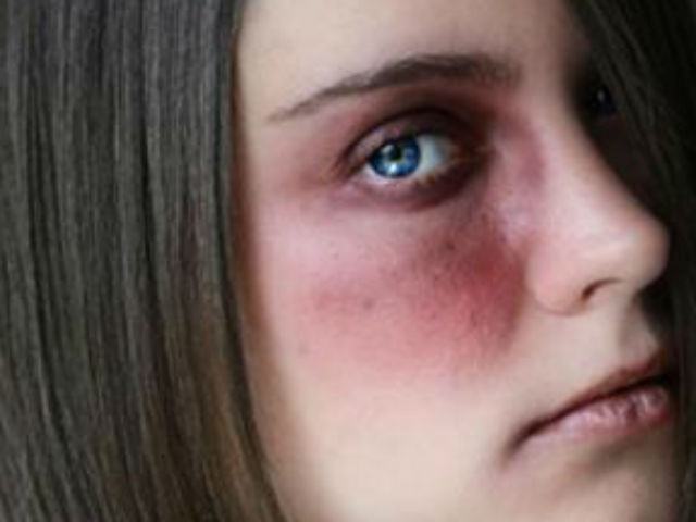 In Calabria 154 mila vittime violenza 51 f793464800f11aa5cefcd2c4dc52569c