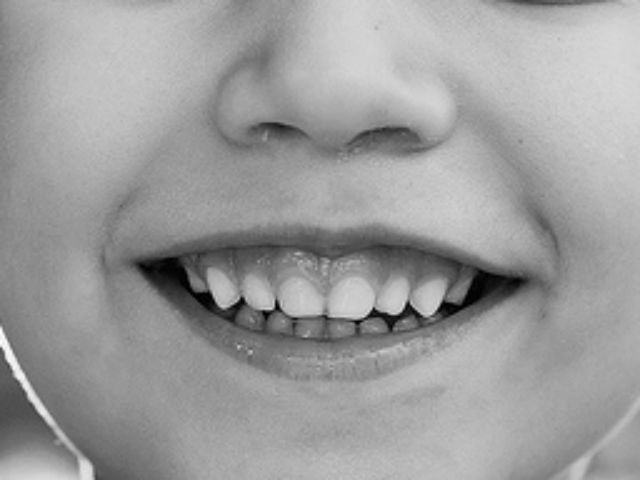 f87ded5e4d4df018eb2f8408a972a0ab