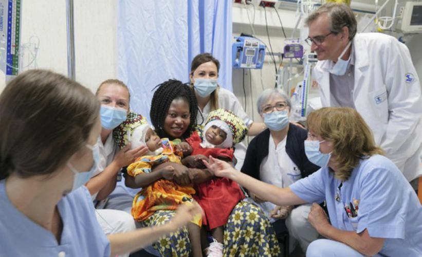 gemelle siamesi roma