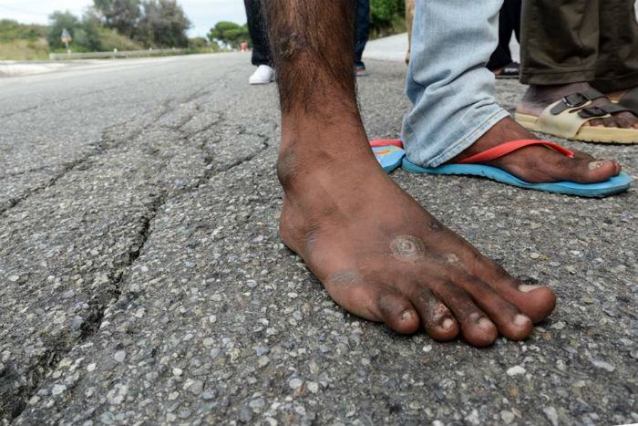 CAS di Roggiano, sopralluogo di LasciateCIEntrare: "Storie di ordinaria malaccoglienza" 51 migranti1 1