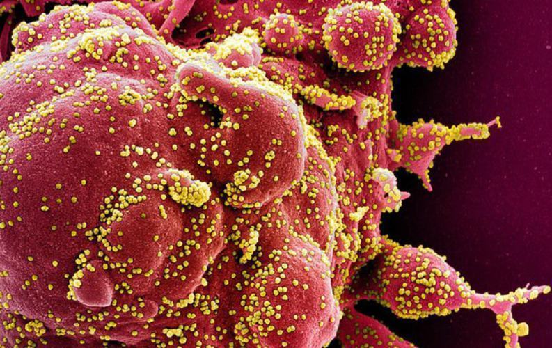 particelle coronavirus 2