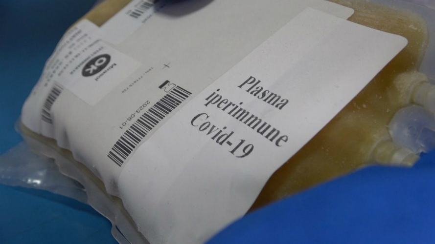 plasma iperimmune