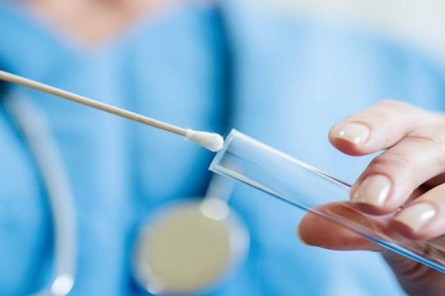 tampone coronavirus 2 2