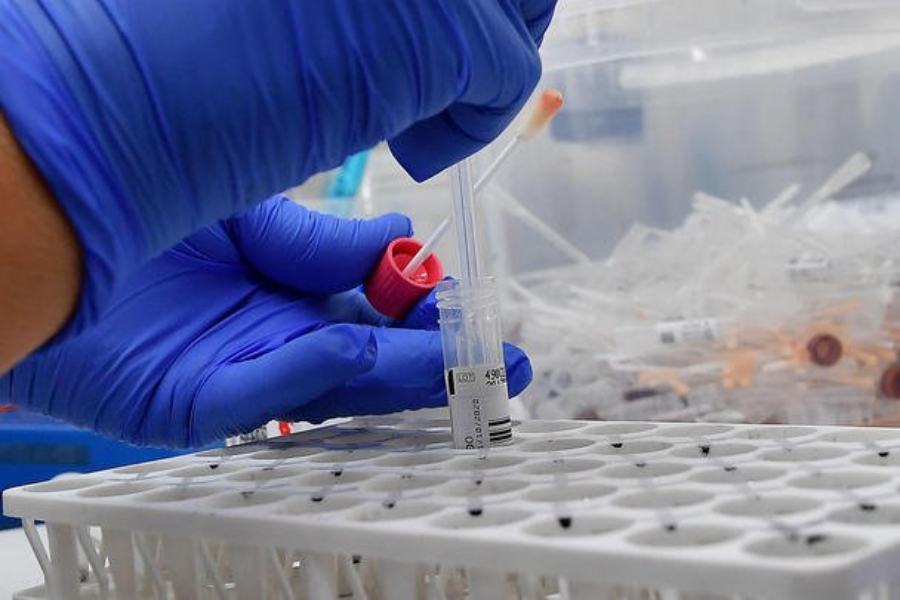 Gimbe: peggiora il dato dei positivi in Calabria, 18% vaccini a categoria 'Altro' 59 tamponi 20