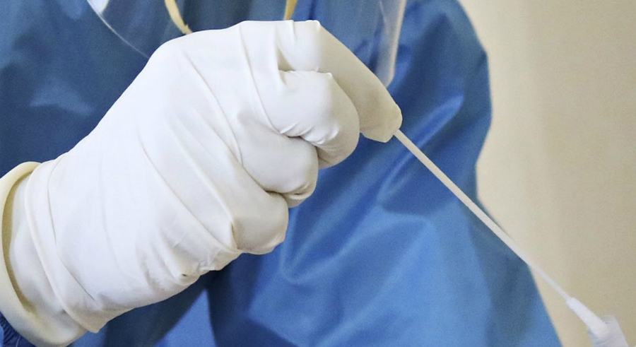 tamponi molecolari covid 1