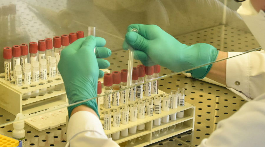 tecnico laboratorio covid